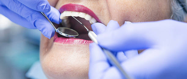 Best Urgent Care for Lost Fillings or Crowns in Breckenridge, TX